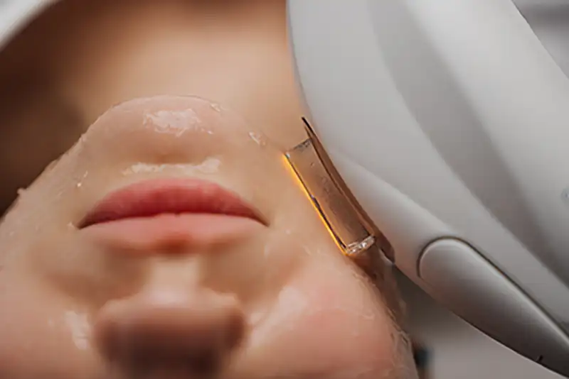 Soin peeling – détail